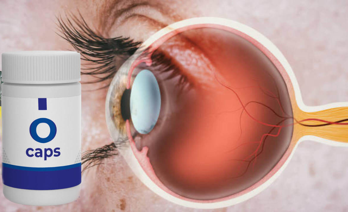 Синдром на замор на очите - симптоми и третман